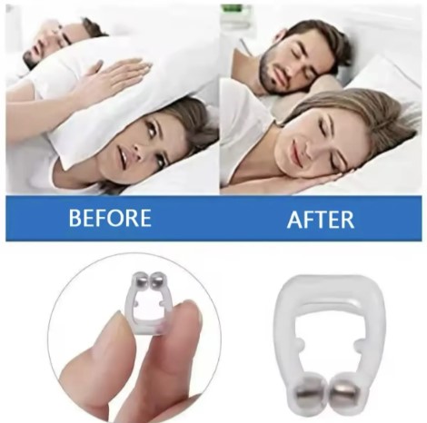 Clip Nasal Anti Ronco – Kit com 4 Unidades – Respire Melhor e Durma Tranquilo