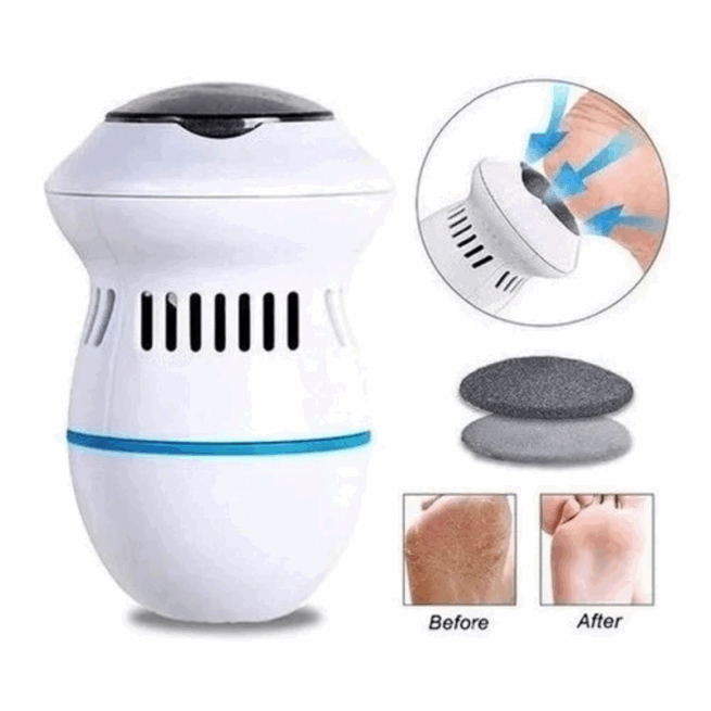 Esfoliador Lixa De Pé Elétrica Recárregavel Motorizado Bivolt - Branco